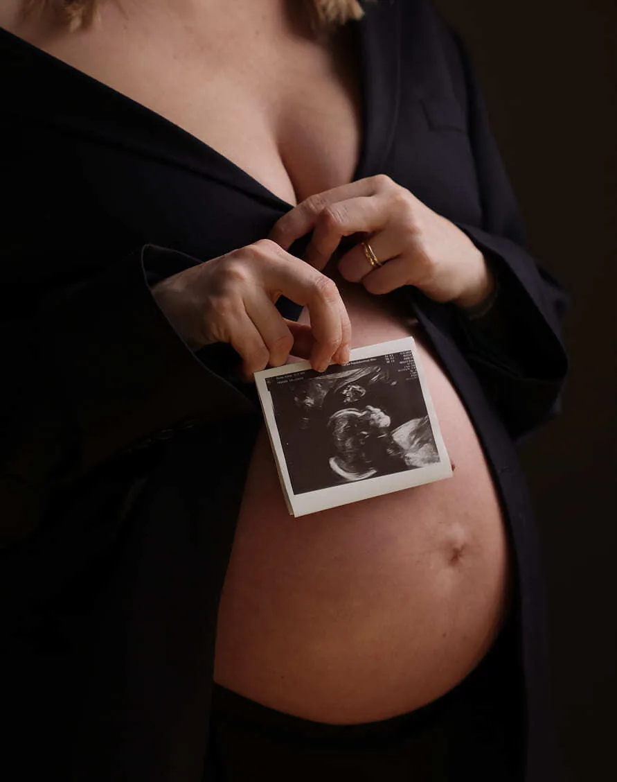 Babybauch Fotoshooting. Fotostudio Ausstellungsstraße